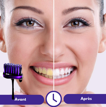 Dentifrice blanchissant︱SmileKit®